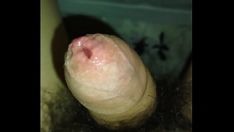 Redare Fimosis boy passjob